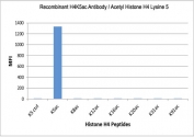 H4K5ac Antibody specificity. Peptide binding analysis demonstrating selective recognition of histone H4 lysine 5 acetylation. Strong signal is observed exclusively for the H4K5ac peptide, with no detectable reactivity toward unmodified lysine 5 (K5 control) or other acetylated histone H4 peptides. These results confirm high specificity of the H4K5ac antibody for chromatin assembly-associated acetylated histone H4.