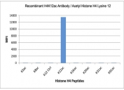 H4K12ac Antibody specificity. Peptide binding analysis demonstrating selective recognition of histone H4 lysine 12 acetylation. Strong signal is observed exclusively for the H4K12ac peptide, with no detectable reactivity toward unmodified lysine 12 (K12 control) or other acetylated histone H4 peptides. These results confirm high specificity of the H4K12ac antibody for chromatin assembly-associated acetylated histone H4.