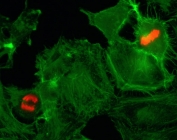 Phospho-Histone H3 (Ser10) Antibody / Mitotic Signaling and Chromatin Activation Antibody (clone RM163) for IF. Immunofluorescence analysis of HIST1H3A / Histone H3 Ser10 phosphorylation in human HeLa cells using Phospho-Histone H3 (Ser10) Antibody / Mitotic Signaling and Chromatin Activation Antibody (red). Strong nuclear staining is observed in mitotic cells, highlighting condensed chromatin consistent with Ser10 phosphorylation during mitosis, while interphase cells show minimal signal. Actin filaments are labeled with fluorescein phalloidin (green), outlining cell morphology, and demonstrate clear contrast with the nuclear phospho-Histone H3 signal.