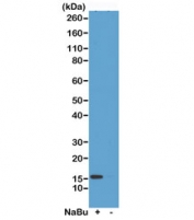 H2A.ZK4ac Antibody / H2AFZ Promoter-Proximal Activation Antibody (clone RM221) for WB. Western blot analysis of H2AFZ / Histone H2A.Z Lys4 acetylation (H2A.ZK4ac) in acid extracts from human HeLa cells untreated (-) or treated (+) with sodium butyrate using H2A.ZK4ac Antibody / H2AFZ Promoter-Proximal Activation Antibody. A band is detected at the predicted molecular weight of approximately 14 kDa in treated cells, consistent with increased histone acetylation and promoter-associated chromatin activation following HDAC inhibition.