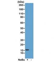 H2A.ZK7ac Antibody / H2AFZ Transcriptional Responsiveness Antibody (clone RM222) for WB. Western blot analysis of H2AFZ / Histone H2A.Z Lys7 acetylation (H2A.ZK7ac) in acid extracts from human HeLa cells untreated (-) or treated (+) with sodium butyrate using H2A.ZK7ac Antibody / H2AFZ Transcriptional Responsiveness Antibody. A band is detected at the predicted molecular weight of approximately 14 kDa in treated cells, consistent with increased histone acetylation and inducible transcriptional responsiveness following HDAC inhibition.