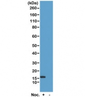 Phospho-Histone H2B Antibody pSer14 / HIST1H2B Apoptotic Chromatin Marker Antibody (clone RM238) for WB. Western blot analysis of HIST1H2B / Histone H2B Ser14 phosphorylation (H2B pS14) in acid extracts of human HeLa cells untreated (-) or treated (+) with nocodazole using Phospho-Histone H2B Antibody pSer14 / HIST1H2B Apoptotic Chromatin Marker Antibody. A band is detected at the predicted molecular weight corresponding to phosphorylated Histone H2B, consistent with induction of apoptosis-associated chromatin condensation and cell cycle stress signaling.