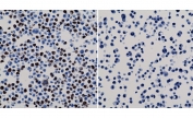 His Tag Antibody Biotin Conjugate Human 293T Cell ICC. Immunocytochemistry was performed using His Tag Antibody Biotin Conjugate clone RM146 on human HEK293T cells expressing a His-tagged nuclear protein (left) and negative control HepG2 cells lacking the tagged protein (right). Bound antibody was detected with streptavidin-HRP and DAB chromogen, followed by hematoxylin counterstaining. Strong nuclear staining is observed in the HEK293T cells expressing the His-tag fusion protein, while the negative control cells show no detectable staining. These results demonstrate that this Biotin His Tag Antibody provides specific detection of polyhistidine-tagged recombinant proteins in immunocytochemistry using a sensitive streptavidin-based detection system.