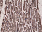 ACC Antibody Human Heart IHC. Immunohistochemistry analysis of Acetyl-CoA carboxylase 1 (ACACA) expression in FFPE human heart tissue using ACC1 Antibody - Lipogenesis Enzyme (clone RM232). Cytoplasmic HRP-DAB brown staining is observed in cardiac muscle cells, highlighting metabolic enzyme expression within cardiomyocytes, while nuclei are counterstained blue. The staining pattern is consistent with the cytosolic localization of ACC1 and reflects the metabolic activity of cardiac tissue.