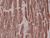 Recombinant Desmin Antibody Human Heart IHC. Immunohistochemistry testing of FFPE human heart tissue with recombinant Desmin antibody at 1:4000.