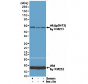 Phospho-AKT (pSer473) Antibody HEK293 WB. Western blot analysis of human HEK293 cell lysates cultured with serum (+), serum starved (-), or treated with insulin using phospho-AKT antibody detecting AKT phosphorylated at Ser473, clone RM251. A band is detected at approximately 60 kDa, consistent with the predicted molecular weight of AKT. Signal intensity is reduced under serum starvation and increased following insulin treatment, consistent with activation of PI3K-AKT signaling. Total AKT is shown as a loading control.