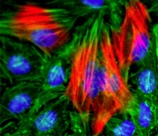 Calponin Antibody HeLa IF. Immunofluorescence analysis of human HeLa cells using Calponin antibody (red). The recombinant antibody clone RM262 shows filamentous cytoplasmic staining consistent with Calponin 1 / CNN1 localization along actin-associated structures. Actin filaments are labeled with fluorescein phalloidin (green), and nuclei are counterstained with DAPI (blue). The merged signal highlights cytoskeletal organization and supports the role of Calponin as an actin-binding protein in immunofluorescence applications.