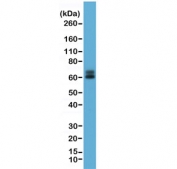 Western blot testing of human HeLa cell lysate with recombinant Paxillin antibody at 1:1000. Predicted molecular weight: 61/65/66 kDa (alpha/beta/gamma).
