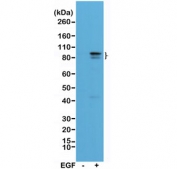 Phospho-STAT3 (pTyr705) Antibody A431 WB. Western blot analysis of human A431 cell lysates untreated (-) or treated (+) with epidermal growth factor (EGF) using phospho-STAT3 antibody detecting STAT3 phosphorylated at Tyr705, clone RM261. A band is detected at approximately 86-90 kDa, consistent with the predicted molecular weight of STAT3. Signal intensity is increased in the EGF-treated sample, consistent with activation of JAK-STAT signaling and growth factor-induced transcriptional pathway activation.
