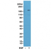 Phospho-EGFR Antibody A431 Stimulated WB. Western blot analysis of human A431 cell lysate untreated (-) or treated (+) with EGF using phospho-EGFR (Tyr1173) antibody, clone RM269. A band is detected at approximately 140-180 kDa in the EGF-treated sample, consistent with the predicted molecular weight of EGFR and its glycosylated forms. Signal is markedly increased following EGF stimulation, indicating phosphorylation of EGFR at Tyr1173 and confirming activation-dependent detection. Minimal signal is observed in the untreated sample, supporting specificity of the antibody for the phosphorylated form of EGFR.