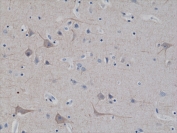 IHC testing of FFPE human brain tissue with recombinant Neurofilament antibody at 1:2500.