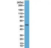 Western blot of human HeLa lysate using recombinant CK7 antibody at 1:2500. Predicted molecular weight ~51 kDa.
