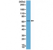 Estrogen Receptor alpha Antibody N-Terminal Region WB. Western blot analysis of Estrogen Receptor alpha antibody in human MCF-7 cell lysate. A distinct band is observed at approximately 66 kDa, consistent with the predicted molecular weight of Estrogen Receptor alpha / ESR1. The antibody used is a recombinant monoclonal directed against the N-terminal region of ER alpha and was applied at a 1:500 dilution. The observed band corresponds to the expected full-length ER alpha protein expressed in hormone-responsive breast carcinoma cells.