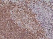 IHC testing of formalin fixed and paraffin embedded human tonsil tissue with recombinant CD79a antibody at 1:200 dilution. HIER: steam section in pH6 citrate buffer for 20 min and allow to cool prior to staining.
