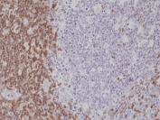 CD5 Antibody for IHC. Immunohistochemistry analysis of CD5 antibody staining in FFPE human tonsil tissue using a C-terminal directed antibody. Strong membranous staining is observed in interfollicular T lymphocytes with dense labeling of T cell zones surrounding germinal centers, while follicular B cell regions remain largely negative. Detection using a C-terminal epitope supports recognition of CD5 independent of extracellular domain accessibility and reflects its intracellular signaling-associated region. Heat-induced epitope retrieval was performed in pH 6 citrate buffer for 20 minutes followed by cooling prior to antibody incubation.