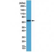 PLAP Antibody A431 WB. Western blot analysis of human A431 cell lysate using PLAP Antibody detects a strong band at approximately 65-70 kDa, consistent with placental alkaline phosphatase / ALPP. Although the predicted molecular weight of PLAP is approximately 58 kDa, the protein is routinely visualized at higher apparent molecular weights due to extensive glycosylation and post-translational processing characteristic of this membrane-associated alkaline phosphatase family member. This N-terminal epitope antibody supports detection of processed ALPP species in epithelial-derived cellular populations.