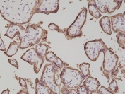PLAP Antibody Placenta IHC. Immunohistochemistry analysis of formalin-fixed, paraffin-embedded human placenta tissue stained with PLAP Antibody demonstrates strong circumferential membranous HRP-DAB brown staining outlining trophoblast-lined chorionic villi and syncytiotrophoblast-associated epithelial surfaces. The staining pattern is consistent with expression of placental alkaline phosphatase / ALPP within placental trophoblastic compartments and highlights membrane-associated localization of this N-terminal epitope antibody. Antibody dilution: 1:500. HIER: steam section in pH6 citrate buffer for 20 min and allow to cool prior to staining.