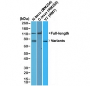 Androgen Receptor Antibody for WB (clone RM255) detects androgen receptor protein in western blot analysis of human 22Rv1 cell lysate using antibodies targeting different AR regions. A band corresponding to full-length androgen receptor is observed at approximately 110 kDa, while additional lower molecular weight bands represent androgen receptor variant isoforms commonly present in 22Rv1 cells.