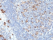 PD-L1 Antibody Tonsil IHC. Immunohistochemistry analysis of PD-L1 (CD274) expression in FFPE human tonsil using recombinant rabbit monoclonal clone RM320 at 1:250. The antibody demonstrates membranous HRP-DAB brown staining in scattered immune cells within interfollicular regions, consistent with localized immune checkpoint activity. The staining pattern highlights heterogeneous PD-L1 expression across immune cell populations within the lymphoid microenvironment.