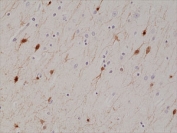 IHC staining of FFPE human brain tissue with recombinant Calretinin antibody at 1:1000.