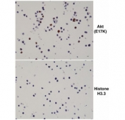 AKT E17K Mutant Antibody Cell Pellet IHC. Immunohistochemistry of FFPE human 293T cell pellets transfected with an AKT E17K expression construct shows distinct HRP-DAB brown cytoplasmic and nuclear staining in E17K-expressing cells, while control cells expressing Histone H3.3 show minimal background, supporting mutation-specific detection of the AKT E17K variant; clone RM336 was used for staining.