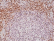 CD3 epsilon Antibody Immunohistochemistry. Analysis of CD3 Epsilon / CD3E staining in FFPE human tonsil tissue using a recombinant antibody targeting this T cell receptor signaling component. Strong HRP-DAB brown membranous and cytoplasmic staining is observed in T lymphocytes within interfollicular and paracortical regions surrounding germinal centers, consistent with T-cell zone localization, while germinal center B-cell areas show reduced staining. The pattern highlights CD3 epsilon as a core component of T cell receptor signaling within lymphoid tissue architecture.