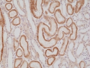 AMACR Antibody Kidney Immunohistochemistry. IHC staining of FFPE human kidney tissue with recombinant AMACR antibody at 1:1000.
