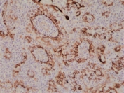 IHC staining of FFPE human tonsil tissue with recombinant Cytokeratin 17 antibody at 1:1000.