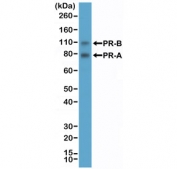 PR Antibody for WB analysis of Progesterone receptor / PGR by western blot. Human T-47D cell lysate was analyzed using PR Antibody for WB (clone RM357) at 1:2000 dilution. A band is detected at approximately 82-94 kDa corresponding to the predicted molecular weight of the PR-A isoform and a second band at approximately 99-120 kDa corresponding to the larger PR-B isoform of Progesterone receptor (PGR). The two bands reflect the well-characterized alternative transcription start sites that generate the PR-A and PR-B receptor isoforms commonly detected in hormone-responsive breast cancer cell lines such as T-47D.