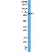 SATB2 Antibody K562 Cell WB. Western blot testing of human K562 cell lysate with recombinant SATB2 antibody at 1:1000 dilution. Predicted molecular weight ~83 kDa.