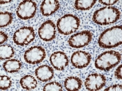 SATB2 Antibody Colon Immunohistochemistry. IHC staining of FFPE human colon tissue with recombinant SATB2 antibody at 1:1000.