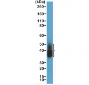 Napsin A Antibody for WB. Western blot analysis of Napsin A (NAPSA) expression in human lung tissue lysate demonstrates a band at approximately 38-45 kDa, consistent with the predicted molecular weight of this glycosylated lysosomal aspartic protease. Clone RM366 detects Napsin A with strong signal in lung-derived tissue, aligning with the known enrichment of this protein in pulmonary epithelial cells and its role as a lung adenocarcinoma marker.