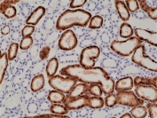 IHC staining of FFPE human kidney tissue with recombinant Napsin-A antibody (clone RM366) at 1:1000.