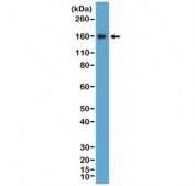 CD21 Antibody Daudi WB. Western blot analysis of Complement Receptor 2 / CD21 in human Daudi cell lysate using recombinant CD21 antibody. A band is detected at approximately 150-160 kDa, consistent with glycosylated CD21, which migrates above its predicted molecular weight of approximately 113 kDa due to post-translational modification of this B-cell surface receptor.