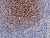CD21 Antibody Germinal Center IHC. Immunohistochemistry of Complement Receptor 2 / CD21 in FFPE human tonsil tissue using recombinant rabbit monoclonal CD21 antibody, clone RM372. HRP-DAB brown staining highlights dense membranous labeling of B lymphocytes within germinal center regions with an underlying reticular follicular dendritic cell network, while surrounding lymphoid cells show minimal staining and nuclei are counterstained blue.