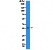 NKX2.1 Antibody for WB. Western blot analysis of human TT cell lysate. Lane 1: human TT cell lysate. The recombinant rabbit monoclonal clone RM373 antibody detects a band at approximately 38-45 kDa, consistent with the predicted molecular weight of Thyroid transcription factor 1 (NKX2-1). NKX2-1 is a nuclear homeobox transcription factor expressed in epithelial cells of lung and thyroid lineage, and detection of this band in TT cell lysate reflects expression of the transcription factor in thyroid-derived cells. Antibody dilution: 1:20,000.
