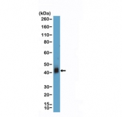 CD38 Antibody for WB human Jurkat lysate. Western blot analysis of CD38 / plasma cell marker expression in human Jurkat cell lysate using CD38 Antibody for WB at 1:1000 dilution. Lane 1: human Jurkat cell lysate. A band is detected at approximately 40â45 kDa, consistent with the predicted molecular weight of CD38, with higher apparent molecular weight reflecting glycosylation of this cell surface protein and aligning with expression in activated T cell-derived lines.
