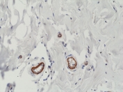 Recombinant VEGFA Antibody Human Breast IHC. Immunohistochemical staining of FFPE human breast tissue using Recombinant VEGFA Antibody (clone RM391) at 1:200 dilution. An HRP-conjugated secondary antibody with DAB substrate was used for detection. Recombinant VEGFA Antibody demonstrates VEGFA expression in vascular-associated structures within breast tissue, supporting studies of angiogenesis, endothelial signaling, vascular remodeling, and VEGF-mediated regulation of tissue homeostasis.
