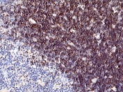 CD1A Antibody for IHC. Immunohistochemistry analysis of CD1A / CD1a expression in FFPE human thymus tissue using CD1A Antibody. Strong membranous and cytoplasmic staining is observed in cortical thymocytes, while medullary regions show reduced staining intensity. The pattern highlights CD1a expression in developing T-cell populations and supports evaluation of antigen-presenting cell interactions within the thymic microenvironment, consistent with roles in epithelial-associated immune surveillance.