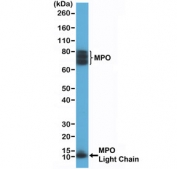 Myeloperoxidase Antibody for WB / MPO Western Blot Antibody (clone RM407). Western blot analysis of human HL60 cell lysate using recombinant Myeloperoxidase antibody for WB (clone RM407) at 1:200 dilution. Bands are detected at approximately 13 kDa and ~70-75 kDa, consistent with the light (beta) chain and the heavy (alpha) chain associated form of Myeloperoxidase / MPO. Additional higher molecular weight signal near ~150 kDa may represent the mature glycosylated MPO enzyme complex. The presence of multiple bands reflects the known proteolytic processing and glycosylation of MPO during granulocyte maturation.