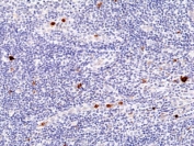 Myeloperoxidase Antibody Human Tonsil Tissue IHC. Immunohistochemistry staining of FFPE human tonsil tissue with recombinant Myeloperoxidase antibody at 1:100.