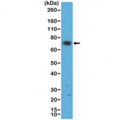 ZAP70 Antibody for WB / T-cell Signaling Kinase Western Blot Antibody. Western blot analysis of human Jurkat T lymphocyte cell lysate using ZAP70 Antibody for WB / T-cell Signaling Kinase Western Blot Antibody at 1:500 dilution. A band is detected at approximately 70 kDa, consistent with the predicted molecular weight of Zeta-chain-associated protein kinase 70 (ZAP70), a cytoplasmic tyrosine kinase central to T-cell receptor signaling. This result aligns with the known enrichment of ZAP70 in T-cell-derived systems such as Jurkat cells, supporting its role as a core mediator of T-cell signaling pathways.