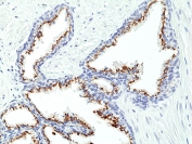 Prostein Antibody for IHC. Immunohistochemistry analysis of Prostein / SLC45A3 antibody staining in FFPE human prostate tissue. Strong cytoplasmic and perinuclear staining is observed in prostate glandular epithelial cells lining luminal structures, consistent with Golgi-associated localization of Prostein, while surrounding stromal cells remain negative. The staining highlights androgen-responsive epithelial cell populations and preserves glandular architecture, supporting the role of SLC45A3 as an androgen-regulated protein in prostate tissue. The antibody was applied at a dilution of 1:100 following heat-induced epitope retrieval in pH 9 Tris-EDTA buffer for 20 minutes and cooling prior to incubation.