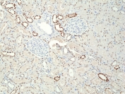 PAX8 Antibody / Epithelial Lineage Transcription Factor Antibody immunohistochemistry in human kidney tissue showing nuclear HRP-DAB brown staining in renal tubular epithelial cells. Paired box protein Pax-8 (PAX8) expression is localized to nuclei lining nephron tubules, with clear staining of epithelial cells forming tubular structures while glomerular and stromal components show minimal to no nuclear signal. The staining pattern highlights transcriptionally active epithelial populations and supports the role of PAX8 as a lineage-defining transcription factor regulating epithelial identity within renal tissue architecture.