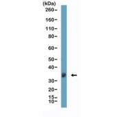 Clusterin Antibody Brain WB. Western blot analysis of human brain tissue lysate using Clusterin antibody for WB. The recombinant rabbit monoclonal antibody clone RM437 detects a band at approximately 36-39 kDa, consistent with the predicted molecular weight of the processed alpha subunit of Clusterin / CLU. This banding pattern reflects proteolytic cleavage of the heterodimer precursor, while higher molecular weight forms may also be present depending on glycosylation and processing state. Detection in brain tissue aligns with the known expression of this secreted glycoprotein in the central nervous system.