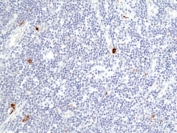 Granzyme B Antibody Human Tonsil IHC. Immunohistochemical staining of FFPE human tonsil tissue using Granzyme B Antibody at a 1:200 dilution. An HRP-conjugated secondary antibody with DAB substrate was used for detection. Granzyme B Antibody, recognizing GZMB, demonstrates granular cytoplasmic staining in scattered lymphocytes within the tonsillar lymphoid tissue, consistent with granzyme B expression in activated cytotoxic T lymphocytes and natural killer cells.