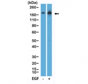 Phospho-EGFR (pTyr1068) Antibody A431 WB. Western blot analysis of human A431 cell lysates untreated (-) or treated (+) with epidermal growth factor (EGF) using phospho-EGFR antibody detecting EGFR phosphorylated at Tyr1068, clone RM443. A band is detected at approximately 170 kDa, consistent with the predicted molecular weight of EGFR. Signal intensity is increased in the EGF-treated sample, consistent with ligand-induced receptor activation and downstream signaling engagement.