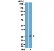 Phospho-EIF4E (pSer209) Antibody MCF-7 WB. Western blot analysis of human MCF-7 cell lysates untreated (-) or treated (+) with fetal bovine serum (FBS) using phospho-EIF4E antibody detecting EIF4E phosphorylated at Ser209, clone RM452. A band is detected at approximately 25-30 kDa, consistent with the predicted molecular weight of EIF4E. Signal intensity is increased in the FBS-treated sample, consistent with growth factor-induced phosphorylation and activation of translation signaling pathways.