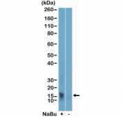 H2BK11ac Antibody / HIST1H2B Transcription Regulation Antibody (clone RM456) for WB. Western blot analysis of HIST1H2B / Histone H2B Lys11 acetylation (H2BK11ac) in acid extracts of human HeLa cells untreated (-) or treated (+) with sodium butyrate using H2BK11ac Antibody / HIST1H2B Transcription Regulation Antibody. A band is detected at the predicted molecular weight corresponding to acetylated Histone H2B, with increased signal in treated cells consistent with enhanced histone acetylation and transcription-associated chromatin regulation following HDAC inhibition.