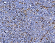 Vimentin Antibody Clone V9 Tonsil IHC. Immunohistochemistry staining of FFPE human tonsil tissue with Vimentin Antibody Clone V9. HIER: boil tissue sections in pH8 EDTA for 20 min and allow to cool before testing.